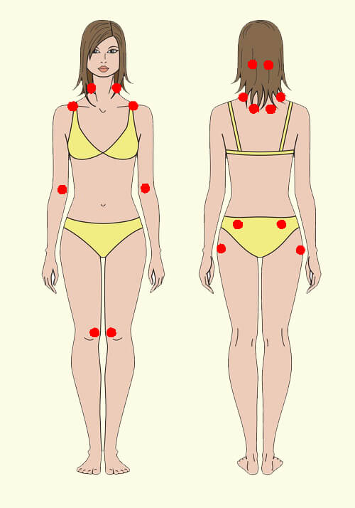 sabervivermais.com - Fibromialgia não é coisa da sua imaginação