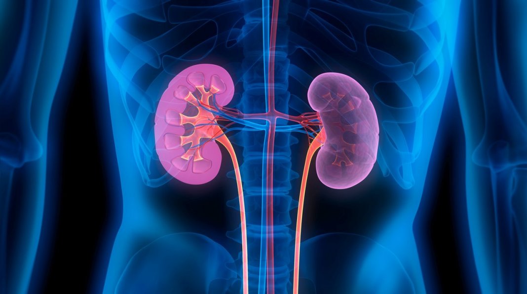Pedras nos rins: causas, sintomas e tratamentos