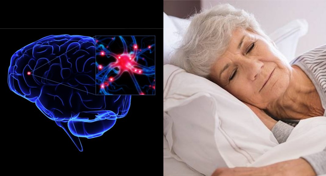 Evite o Alzheimer: apenas 1 exercício, todas as noites antes de dormir