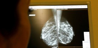 Cientistas identificam composto capaz de bloquear metástases de cânceres