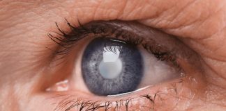 Cientistas desenvolvem colírio que “derrete” a catarata nos olhos