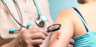 Cientistas criam exame de sangue que detecta estágio inicial do câncer de pele