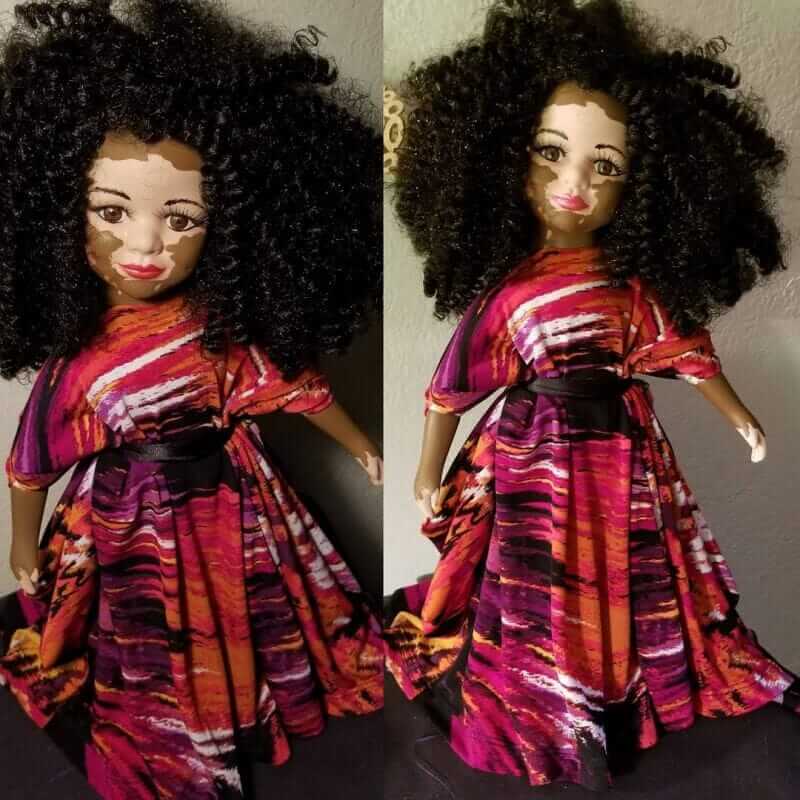 sabervivermais.com - Artista cria uma linha de bonecas com vitiligo e ajuda crianças a se amarem do jeito que são