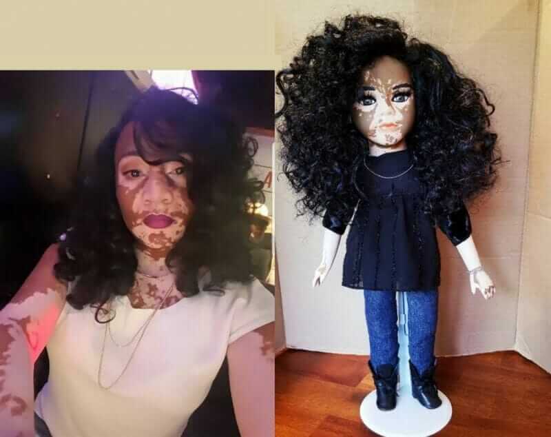 sabervivermais.com - Artista cria uma linha de bonecas com vitiligo e ajuda crianças a se amarem do jeito que são