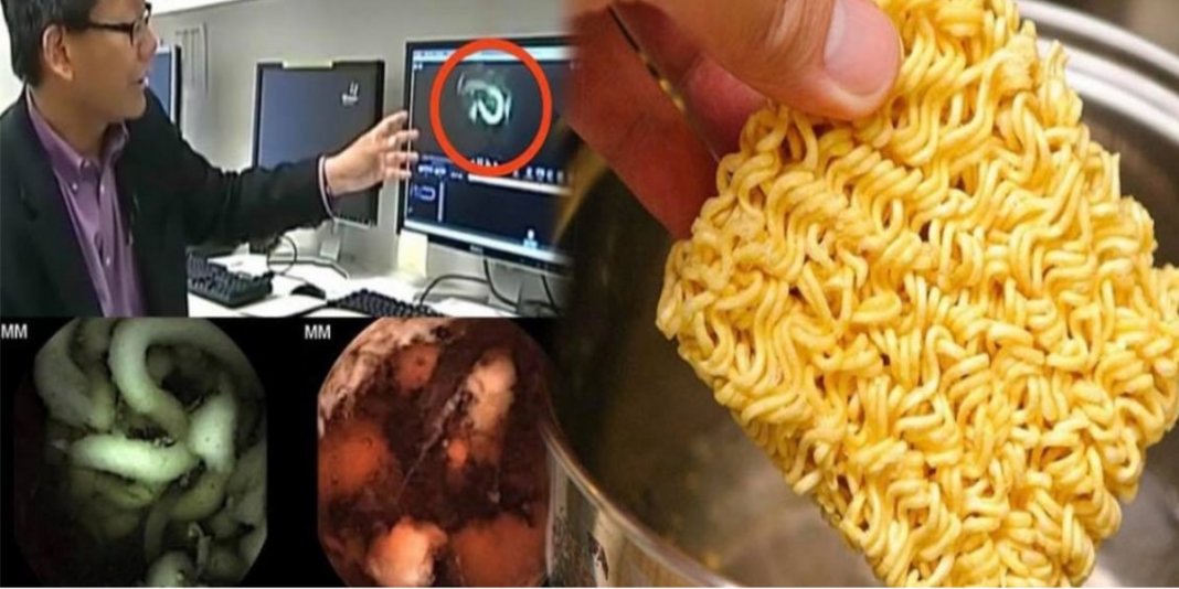 Médico mostra vídeo e dados que a indústria esconde de você sobre o macarrão instantâneo