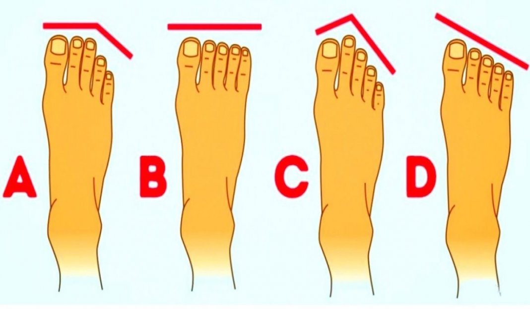 Isto é o que a forma dos seus pés diz sobre sua personalidade