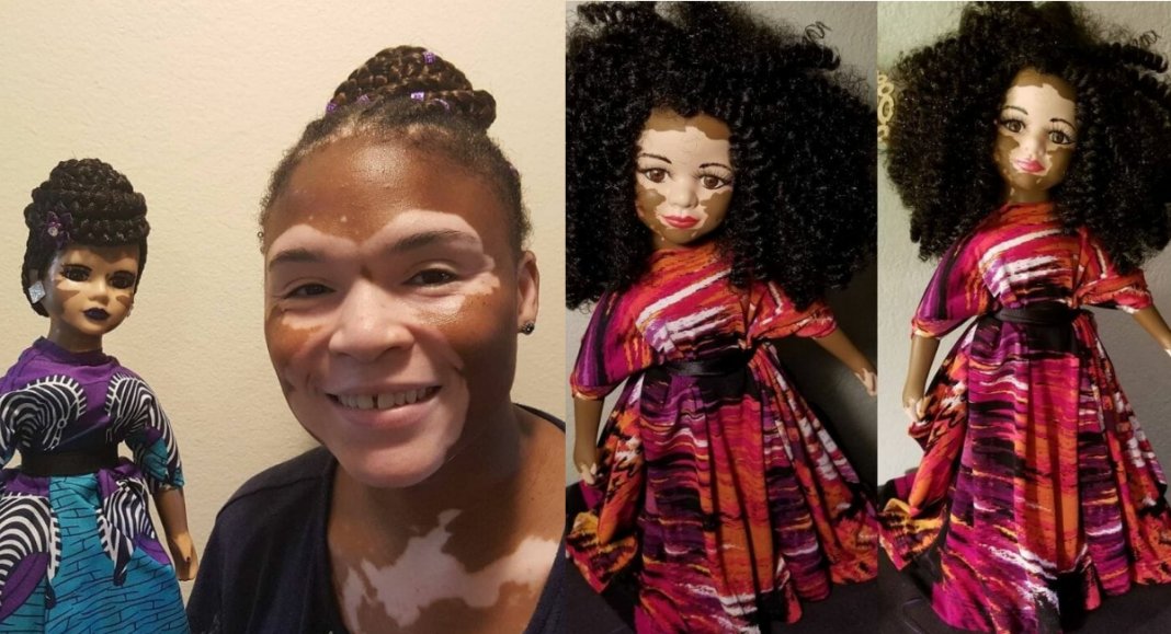 Artista cria uma linha de bonecas com vitiligo e ajuda crianças a se amarem do jeito que são