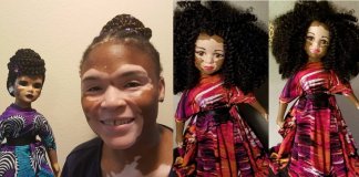 Artista cria uma linha de bonecas com vitiligo e ajuda crianças a se amarem do jeito que são