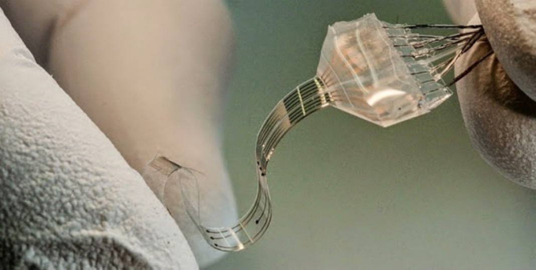 Novo implante na medula permite recuperar a capacidade de andar