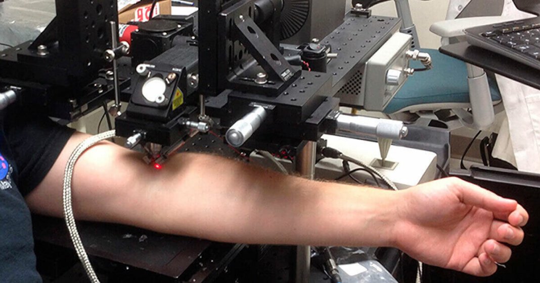 Novo tratamento com laser destrói células cancerosas que circulam no sangue
