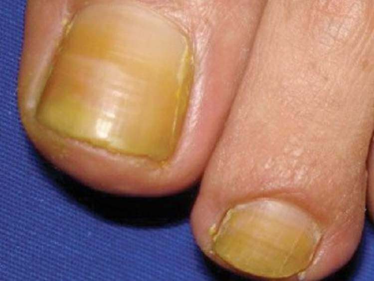 sabervivermais.com - Avaliando a saúde através das unhas