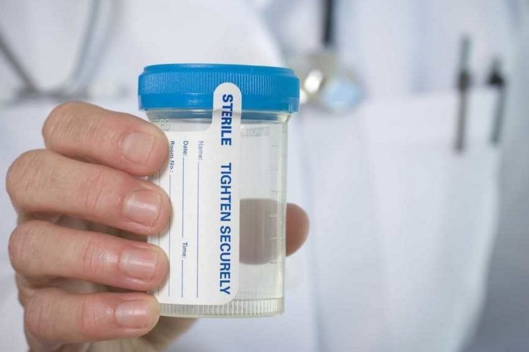 Estudo afirma que um exame de urina poderá substituir papanicolau no futuro