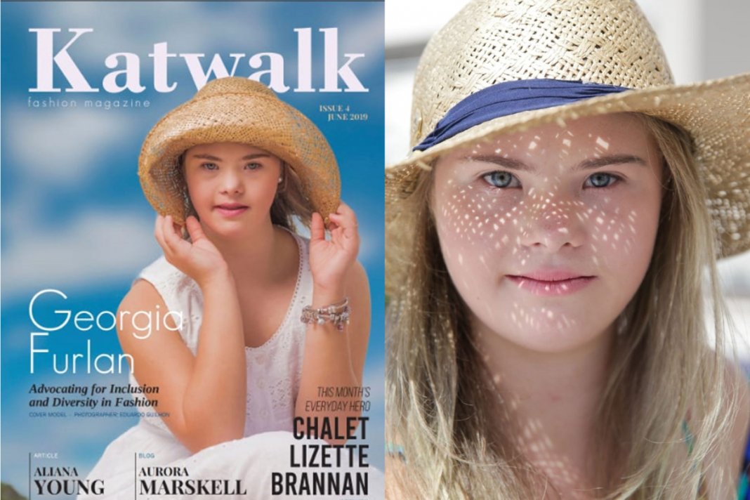 Menina brasileira com síndrome de Down, é capa de revista na Austrália no mês de julho