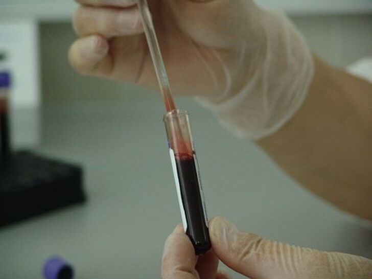 sabervivermais.com - Os alemães criam exames de sangue que prevêem se você morrerá nos próximos 10 anos. É 83% eficaz mas ainda não está sendo testado!