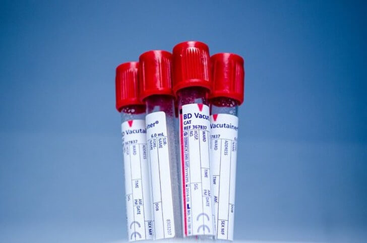 sabervivermais.com - Os alemães criam exames de sangue que prevêem se você morrerá nos próximos 10 anos. É 83% eficaz mas ainda não está sendo testado!