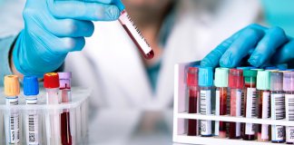 Os alemães criam exames de sangue que prevêem se você morrerá nos próximos 10 anos. É 83% eficaz mas ainda não está sendo testado!