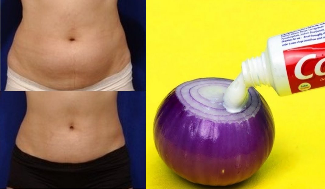 Creme caseiro, reduz a gordura abdominal e diminui o inchaço!