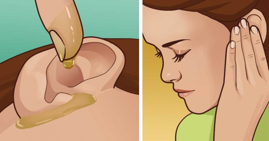 07 remédios caseiros para dor de ouvido