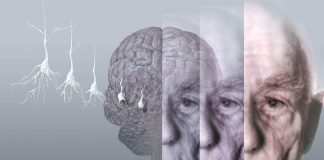 Novo achado aproxima cientistas italianos da cura do Alzheimer