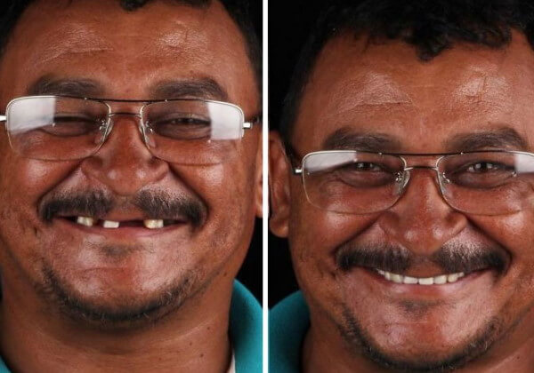 sabervivermais.com - Odontólogo brasileiro restaura sorrisos de graça a pessoas de baixa renda em todo mundo