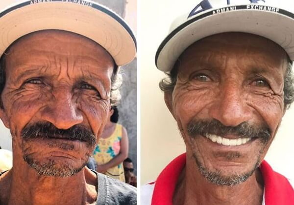 sabervivermais.com - Odontólogo brasileiro restaura sorrisos de graça a pessoas de baixa renda em todo mundo