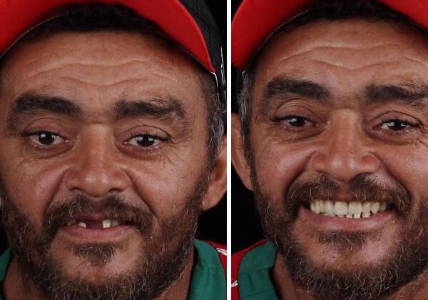 sabervivermais.com - Odontólogo brasileiro restaura sorrisos de graça a pessoas de baixa renda em todo mundo