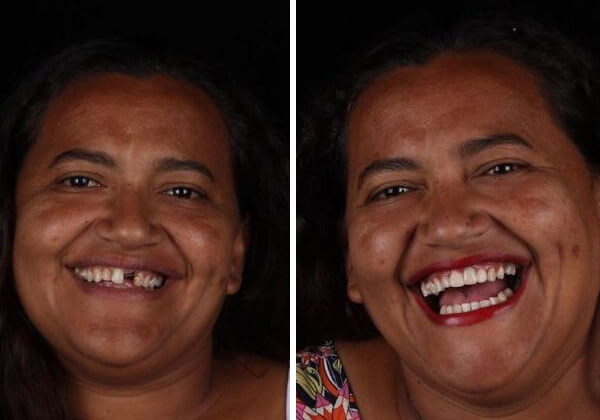 sabervivermais.com - Odontólogo brasileiro restaura sorrisos de graça a pessoas de baixa renda em todo mundo