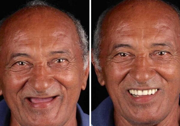 sabervivermais.com - Odontólogo brasileiro restaura sorrisos de graça a pessoas de baixa renda em todo mundo