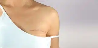 México aprova reconstrução mamária gratuíta para quem teve câncer de mama