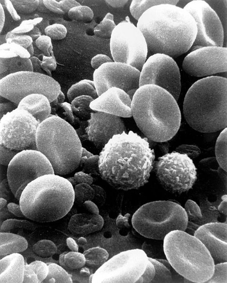 sabervivermais.com - Cientistas encontraram um método para tratar 10 tipos de câncer sem danificar as células saudáveis.