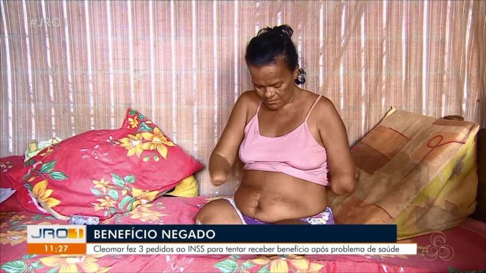 sabervivermais.com - Inacreditável! mulher sem mãos e pernas tem benefício negado por não poder assinar papéis