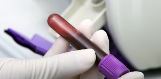 Exames de sangue podem substituir biópsias e ressonâncias magnéticas