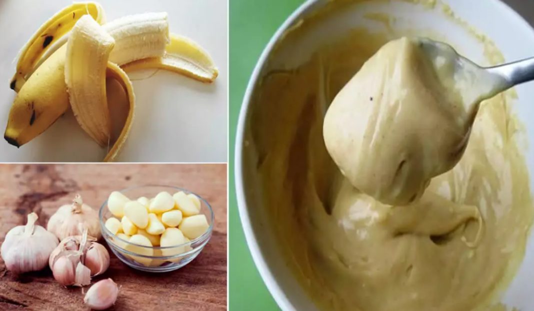 Excelente xarope de alho com banana, protege contra gripe e fortalece a imunidade