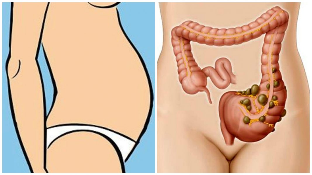 Barriga inchada? Recupere a saúde do seu intestino com está receita!