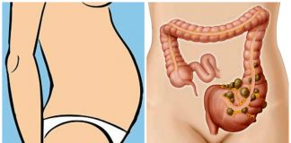 Barriga inchada? Recupere a saúde do seu intestino com está receita!