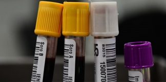 Hemorio e HC irão testar plasma de curados da covid: Um doador pode ajudar 3 pessoas