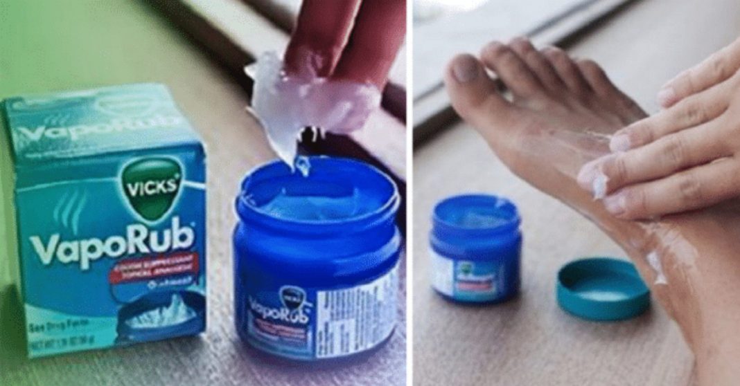 Use Vick Vaporub nós pés antes de dormir, e evite gripes e constipações