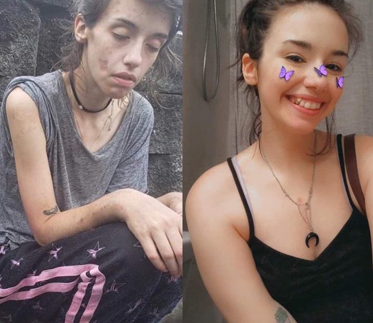 sabervivermais.com - Jovem de 24 anos supera seu vício em drogas e encanta com sua nova aparência. Novo recomeço!