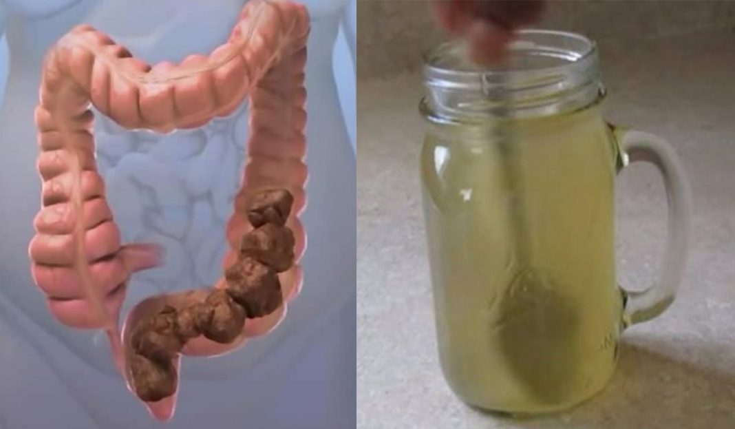 Esta simples bebida vai retirar quilos de toxinas do seu intestino!