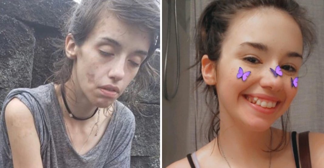 Jovem de 24 anos supera seu vício em drogas e encanta com sua nova aparência. Novo recomeço!