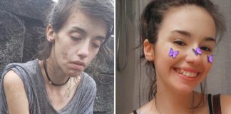 Jovem de 24 anos supera seu vício em drogas e encanta com sua nova aparência. Novo recomeço!