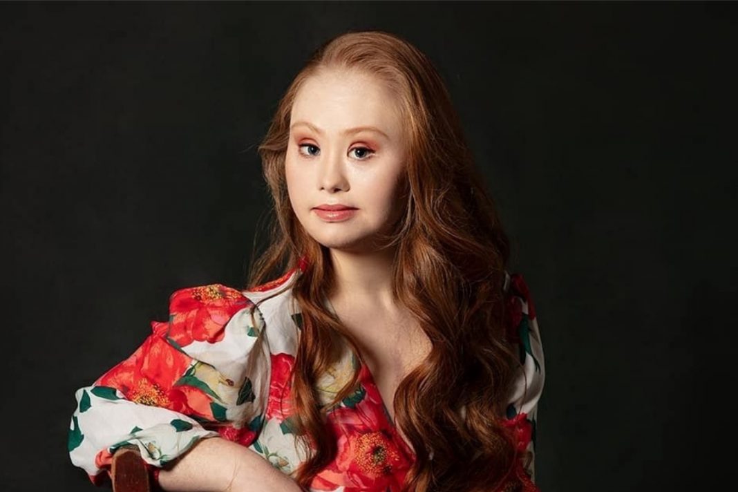 Madeline Stuart, a primeira supermodelo com síndrome de down, revista a considera como um ” fenômeno”