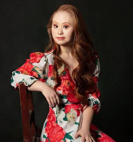 sabervivermais.com - Madeline Stuart, a primeira supermodelo com síndrome de down, revista a considera como um " fenômeno"