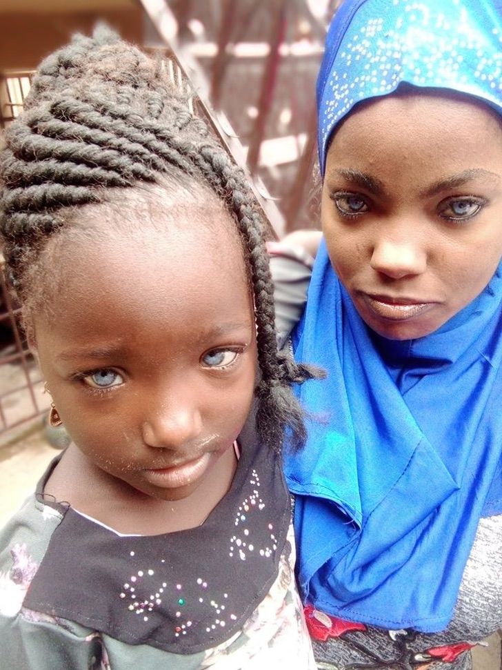 sabervivermais.com - Marido africano abandona esposa e filhas por causa de seus "estranhos olhos" azuis. Eles são de uma rara beleza!