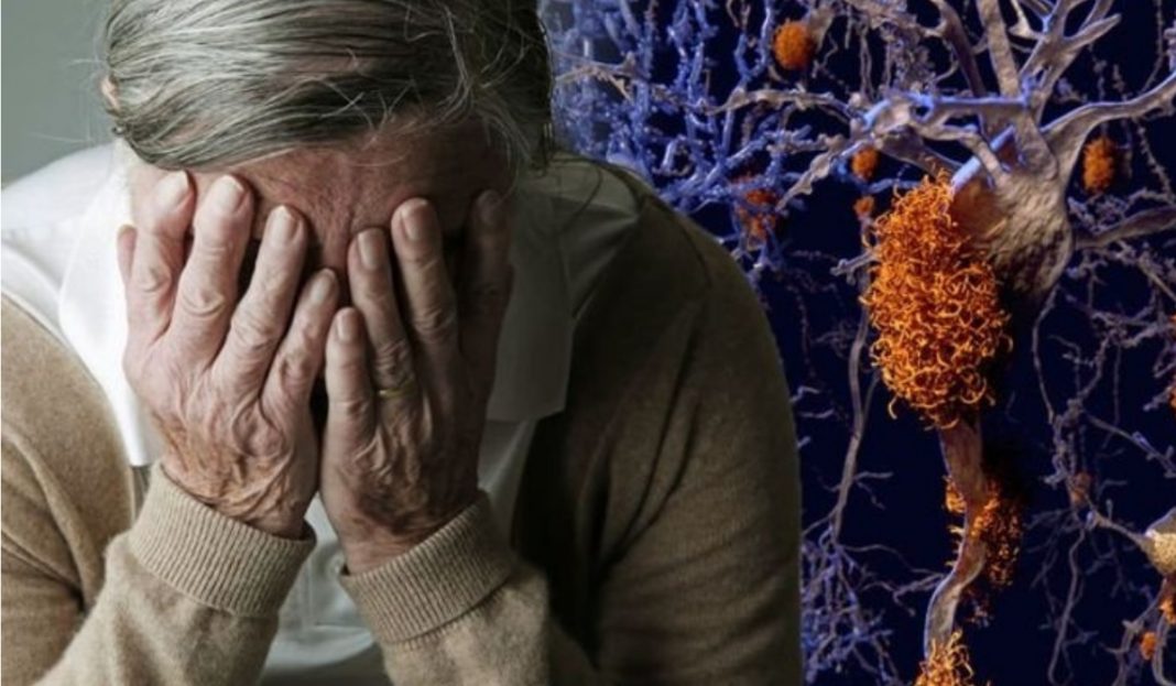 Alzheimer: Pela primeira vez, cientistas revertem a demência com uma droga que reduz a inflamação cerebral