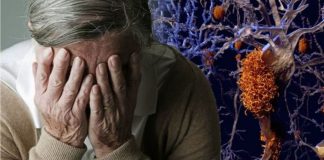 Alzheimer: Pela primeira vez, cientistas revertem a demência com uma droga que reduz a inflamação cerebral