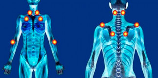 Fibromialgia: como vírus comuns podem estar desencadeando dores que ninguém vê