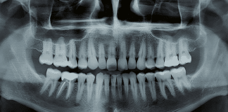 Chega de dentadura ou implantes? Japão testa remédio que faz nascer dentes de novo!