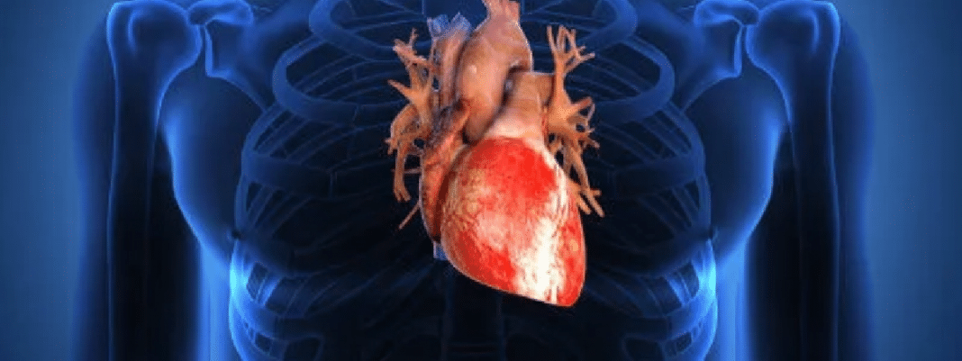 coraçao3 3 SINAIS NO SEU SANGUE QUE PODEM REVELAR UM RISCO OCULTO DE DOENÇAS DO CORAÇÃO (e quase ninguém sabe)