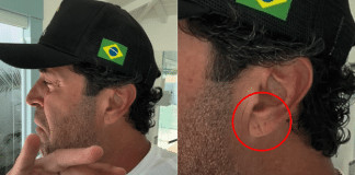 Dobra na orelha pode indicar risco de infarto? Morte de Maderite gerou debate nas redes.